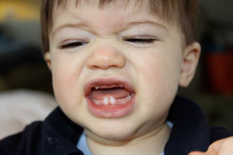 dec-russie-teeth dec-russie-teeth